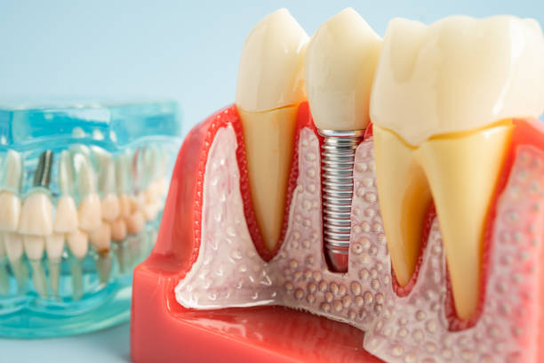 Best Cosmetic Dentistry  in Bullard, TX